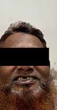 Before - Smile Transformation 1